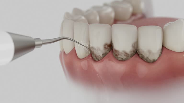 Reliable Teeth Cleaning And Checkup contractor in Gallia County County, OH by Dentist Open Now
